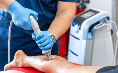Shockwave Therapy: A Thorough Guide to Plantar Fasciitis